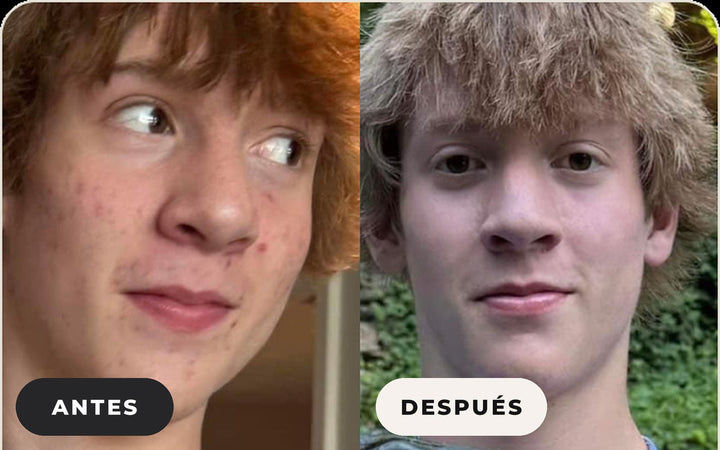 Antes y después de Shannon M.