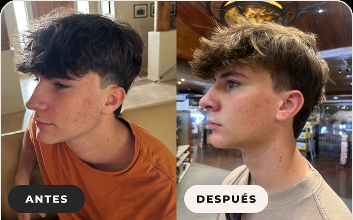 Antes y después de Brad B.