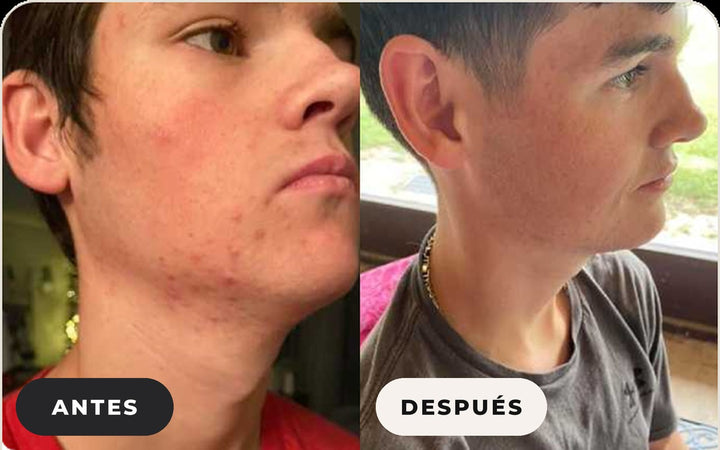 Antes y después de Dona S.