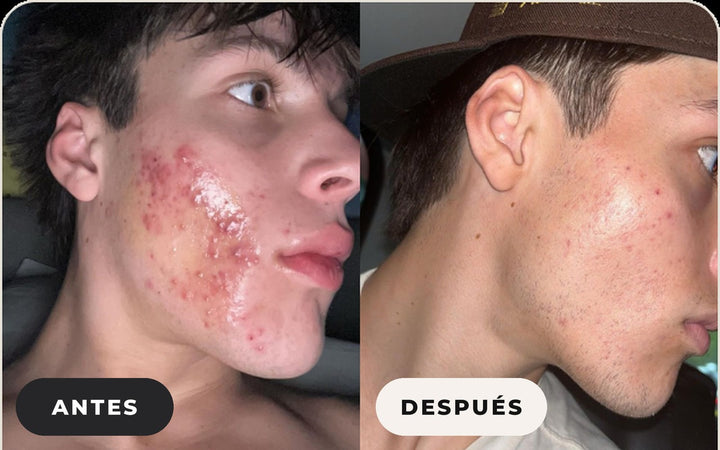 Antes y después de Preston S.