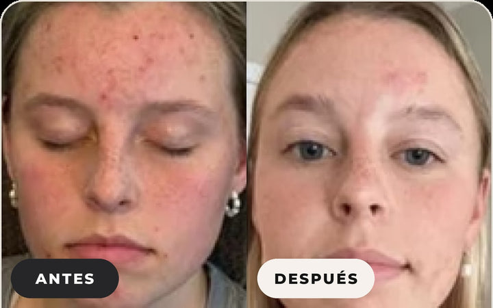 Antes y después de Kelly S.
