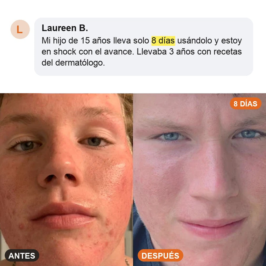 Antes y después tras 8 días