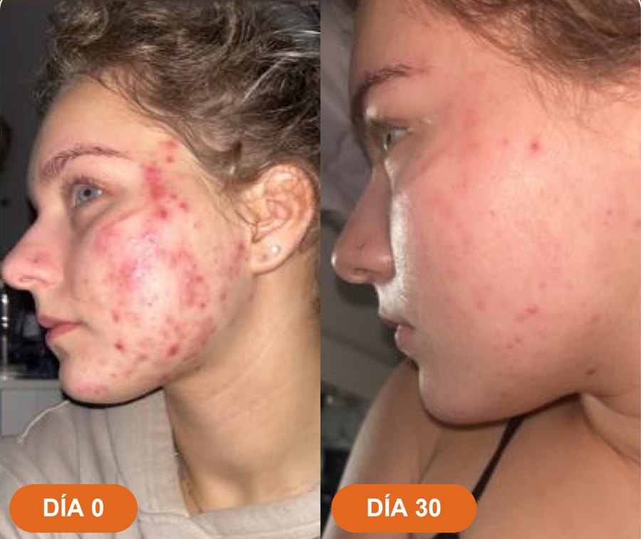Antes y después · Eleonora C.