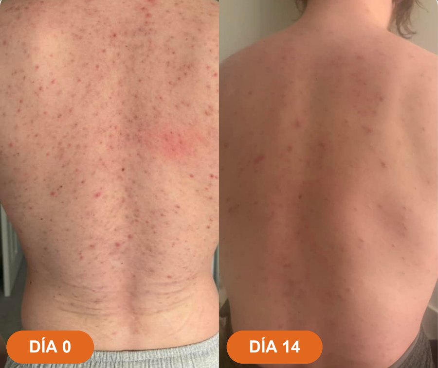 Antes y después · David A.