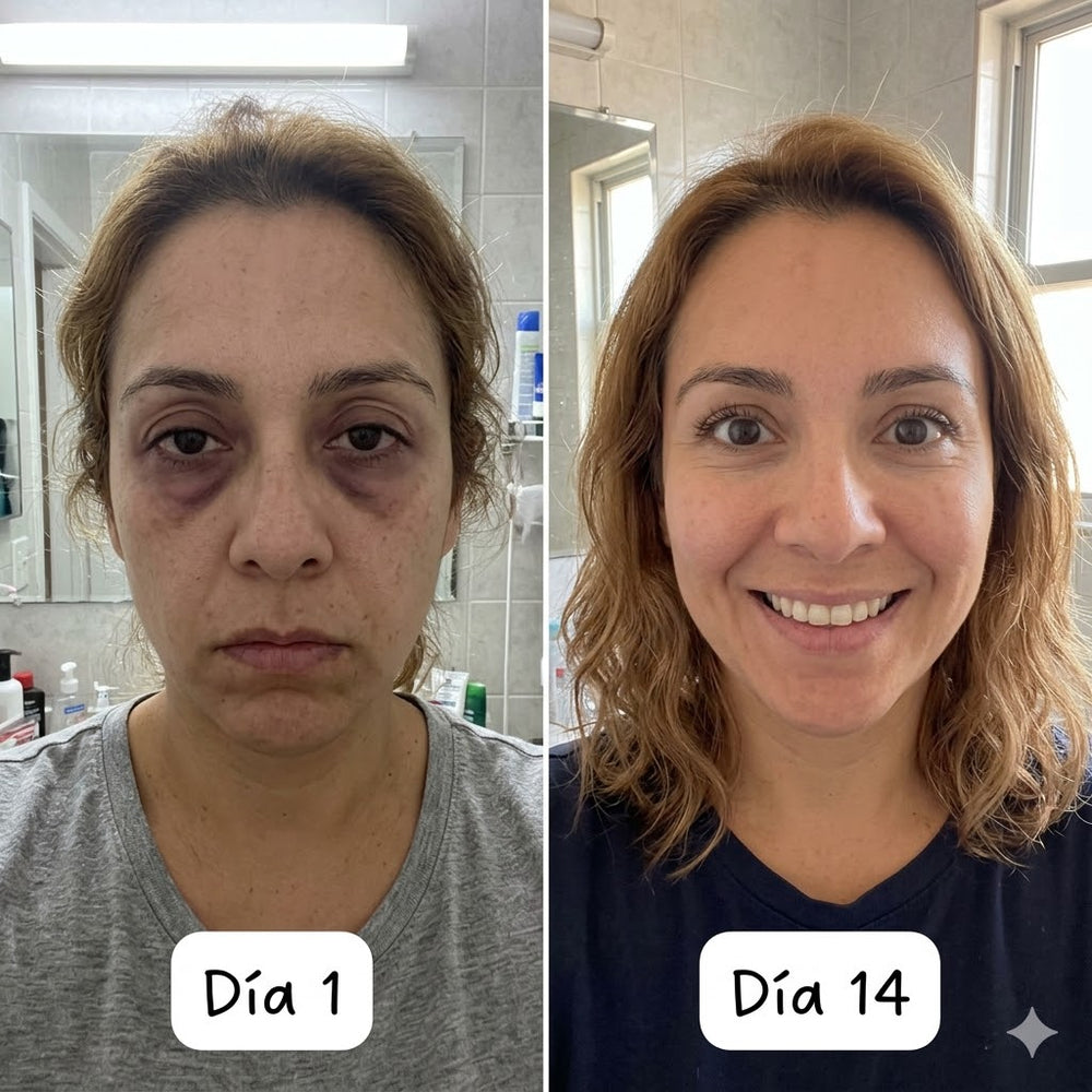 <h2>Resultados Reales, Testimonios Aprobados por <strong>+10,000 Clientas Satisfechas</strong></h2>