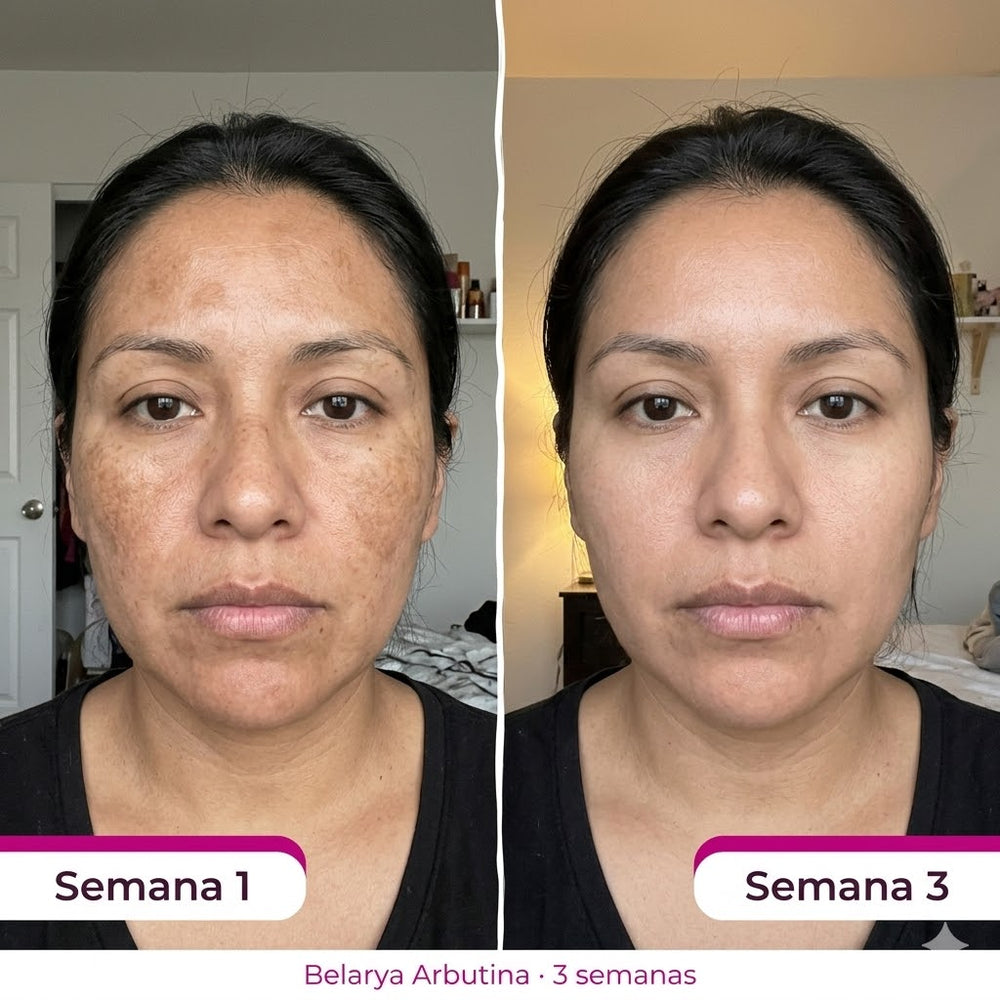 <h2>Resultados Reales, Testimonios Aprobados por <strong>+10,000 Clientas Satisfechas</strong></h2>