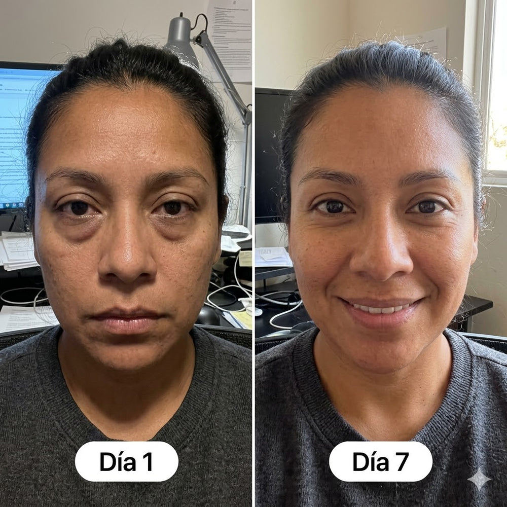 <h2>Resultados Reales, Testimonios Aprobados por <strong>+10,000 Clientas Satisfechas</strong></h2>