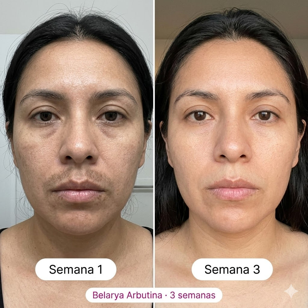 <h2>Resultados Reales, Testimonios Aprobados por <strong>+10,000 Clientas Satisfechas</strong></h2>