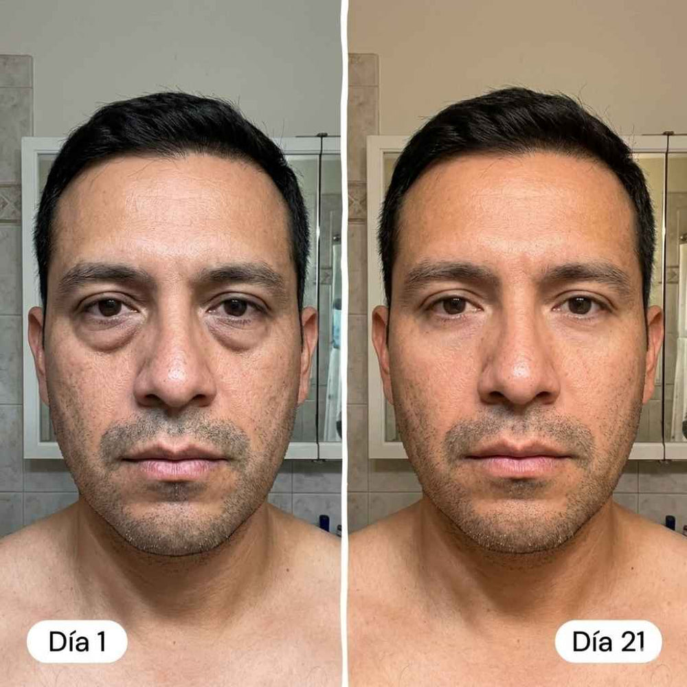 <h2>Resultados Reales, Testimonios Aprobados por <strong>+10,000 Hombres Satisfechos</strong></h2>