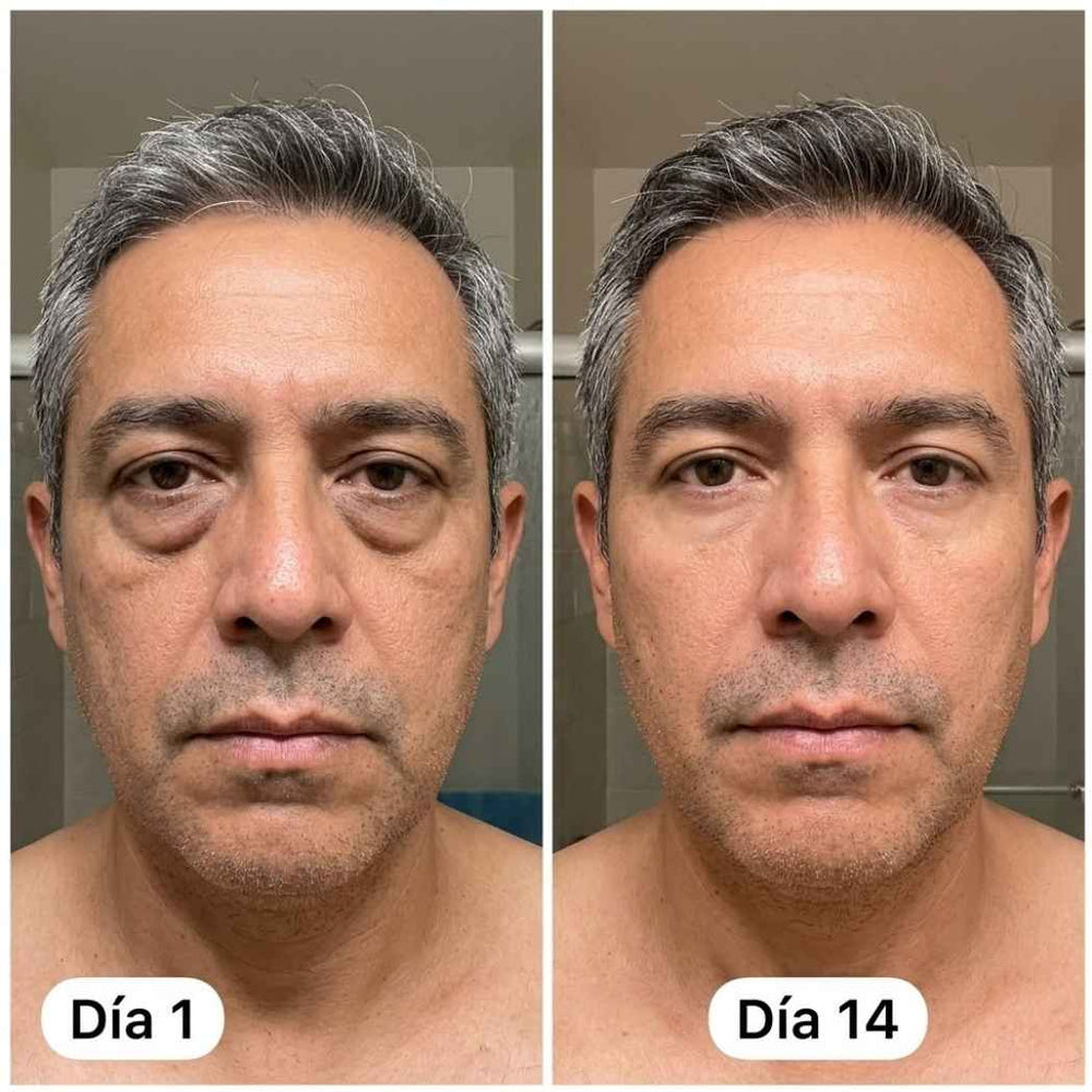 <h2>Resultados Reales, Testimonios Aprobados por <strong>+10,000 Hombres Satisfechos</strong></h2>