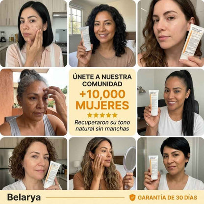 Belarya™ Elimina Manchas Faciales en 4 Semanas