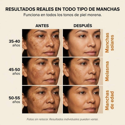 Belarya™ Crema Anti-Manchas - Resultados en 4 Semanas