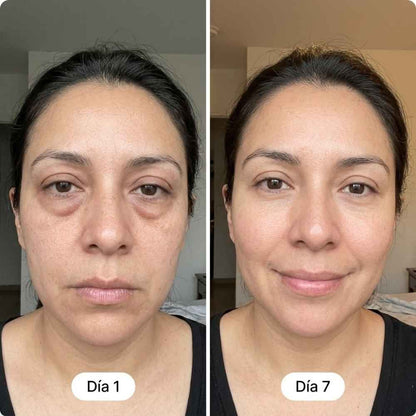 Belarya - Gel Tensor de Ojos Resultados Desde el Primer Uso