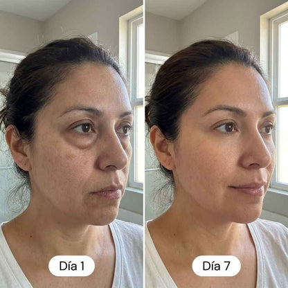 Belarya - Gel Tensor de Ojos Resultados Desde el Primer Uso