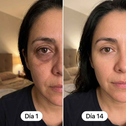Belarya - Gel Tensor de Ojos Resultados Desde el Primer Uso