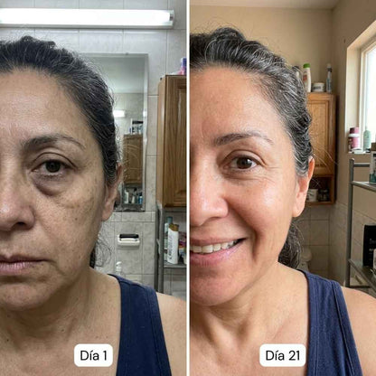Belarya - Gel Tensor de Ojos Resultados Desde el Primer Uso