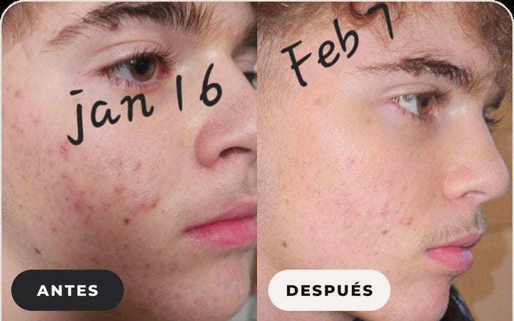 Antes y después de Jennifer T.