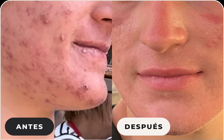 Antes y después de Mandy R.
