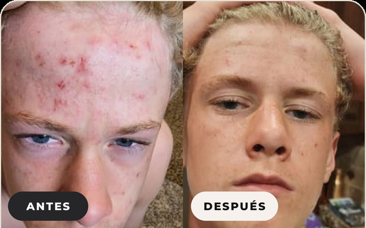 Antes y después de Nick M.