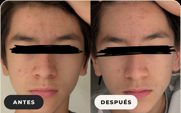Antes y después de Laurie P.