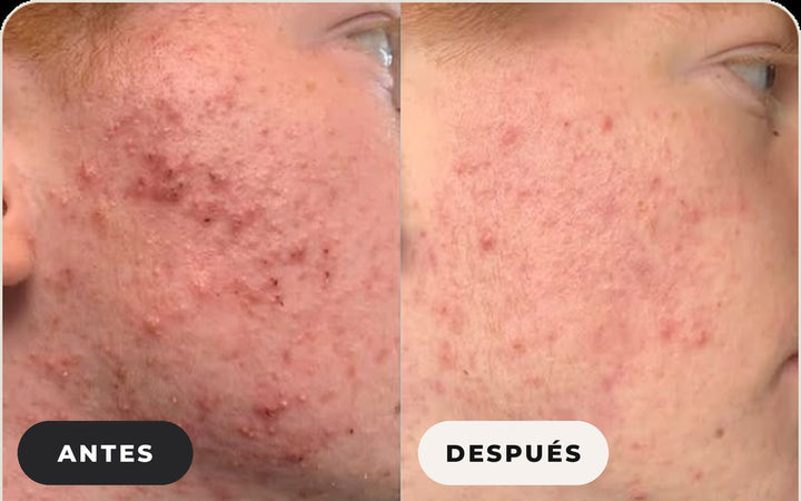 Antes y después de Laurie L.