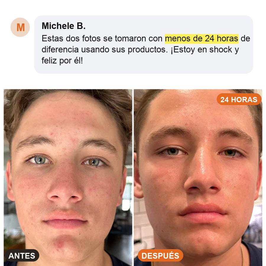Antes y después en menos de 24 horas