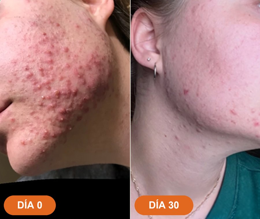 Antes y después · Julia B.