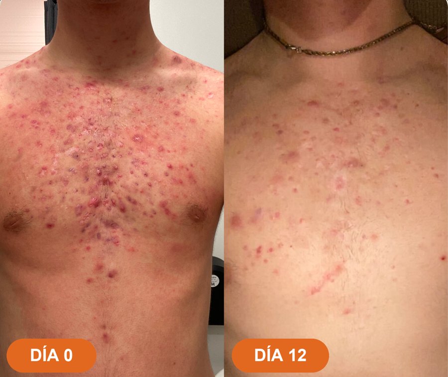 Antes y después · Daniel J.