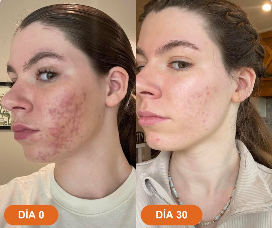 Antes y después · Camila A.