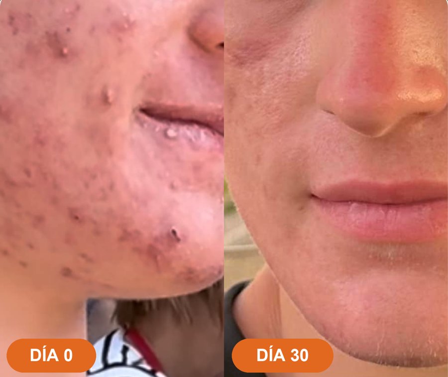 Antes y después · Owen R.